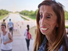 Lizzie Velasquez