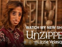 Lizzie Velasquez photo