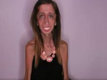 Lizzie Velasquez