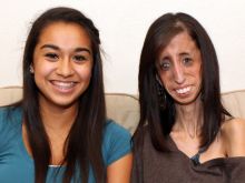 Lizzie Velasquez