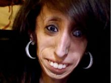 Lizzie Velasquez