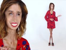 Lizzie Velasquez