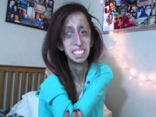 Lizzie Velasquez