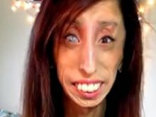 Lizzie Velasquez