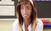 Lizzie Velasquez