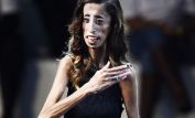 Lizzie Velasquez