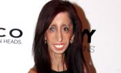 Lizzie Velasquez