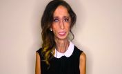 Lizzie Velasquez