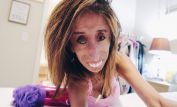 Lizzie Velasquez