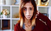 Lizzie Velasquez