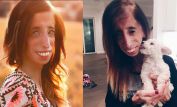 Lizzie Velasquez