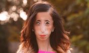 Lizzie Velasquez