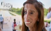 Lizzie Velasquez