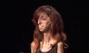 Lizzie Velasquez