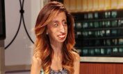 Lizzie Velasquez