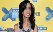 Lizzie Velasquez