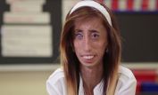 Lizzie Velasquez