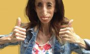 Lizzie Velasquez