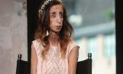 Lizzie Velasquez