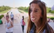 Lizzie Velasquez