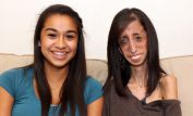 Lizzie Velasquez