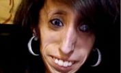 Lizzie Velasquez