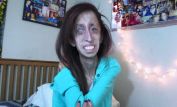 Lizzie Velasquez