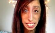 Lizzie Velasquez