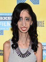 Lizzie Velasquez