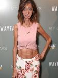 Lizzie Velasquez