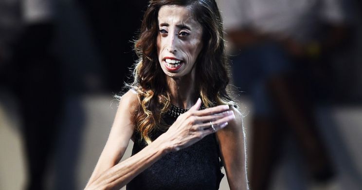 Lizzie Velasquez