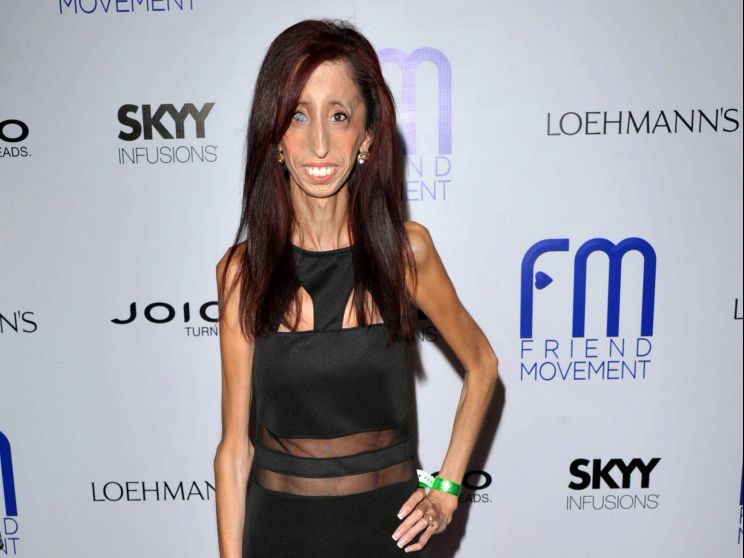 Lizzie Velasquez