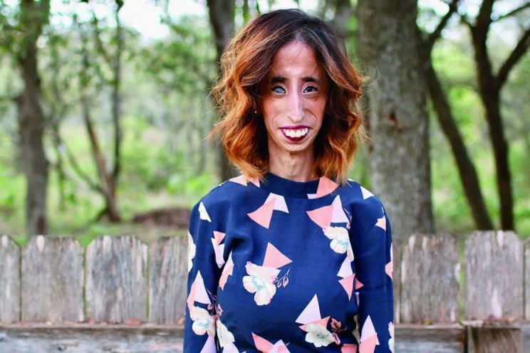 Lizzie Velasquez