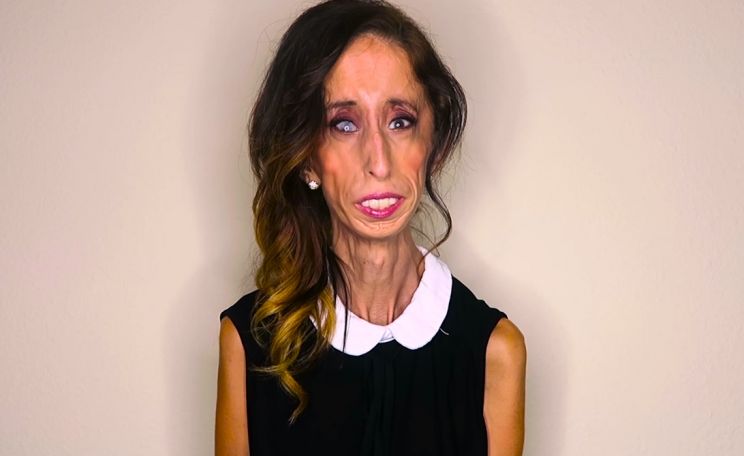 Lizzie Velasquez