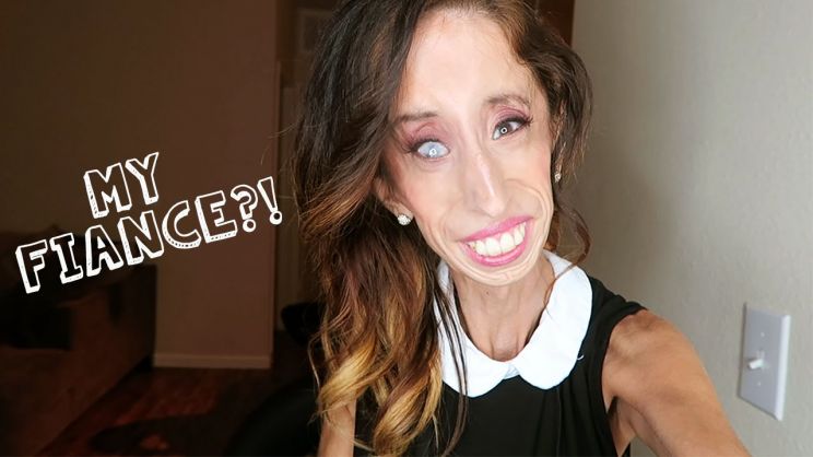 Lizzie Velasquez