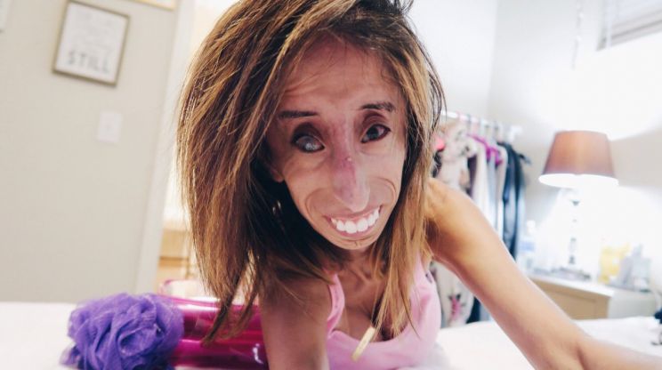 Lizzie Velasquez