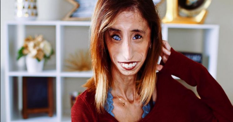 Lizzie Velasquez