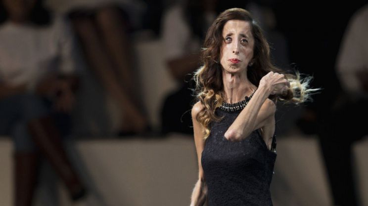 Lizzie Velasquez