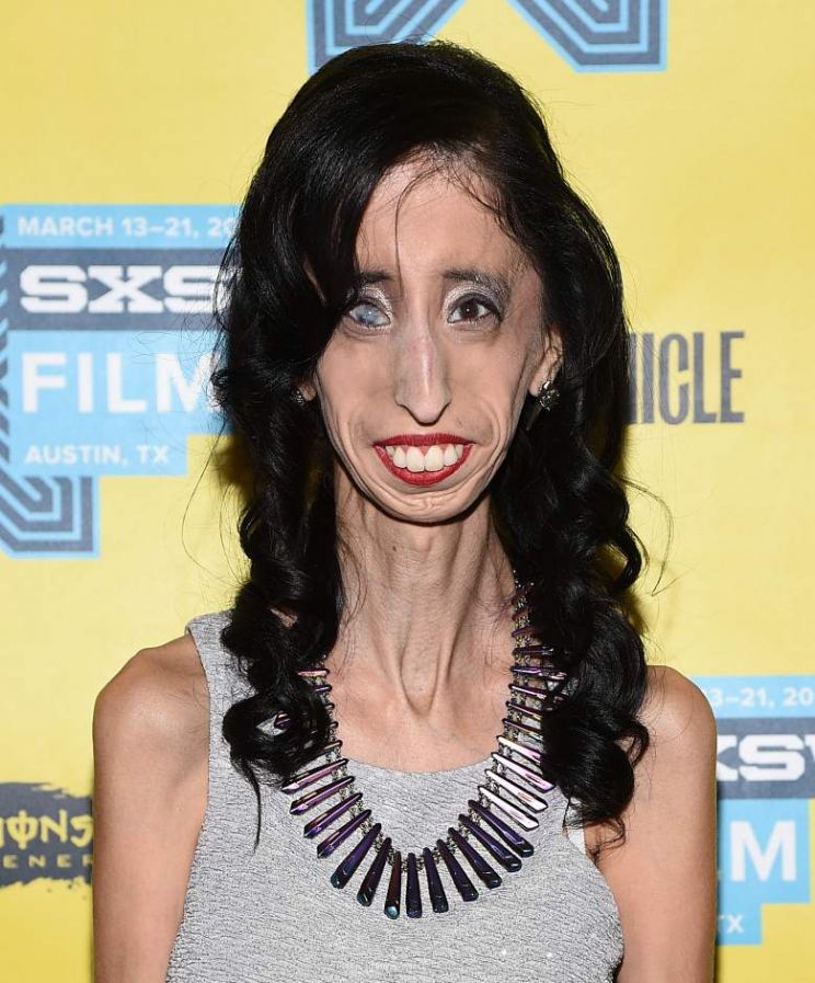 Lizzie Velasquez