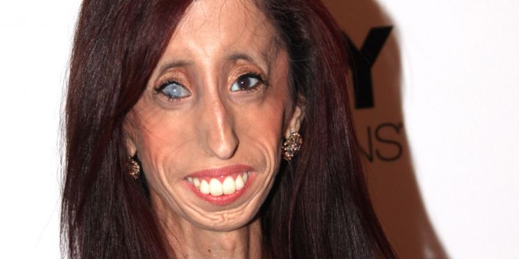 Lizzie Velasquez