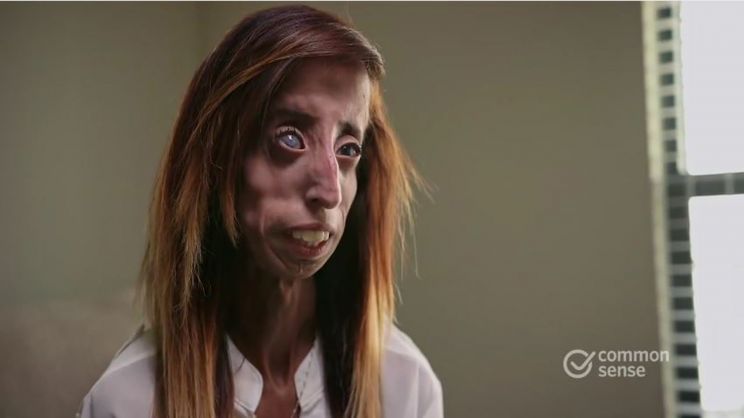 Lizzie Velasquez