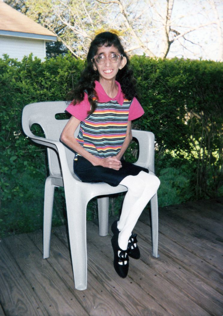 Lizzie Velasquez