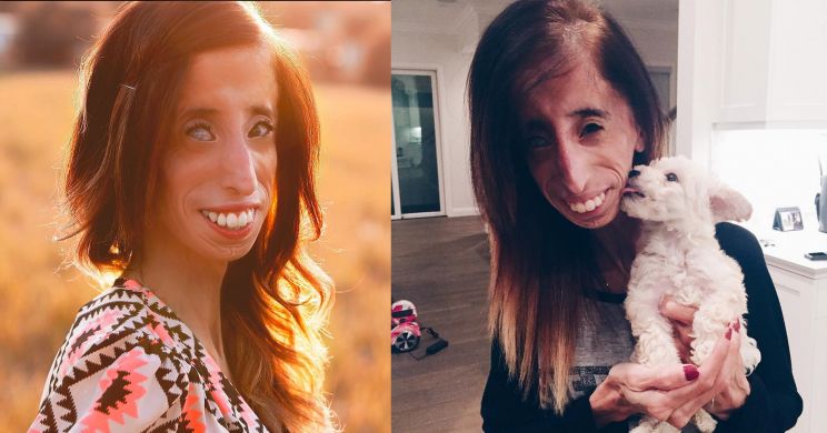 Lizzie Velasquez