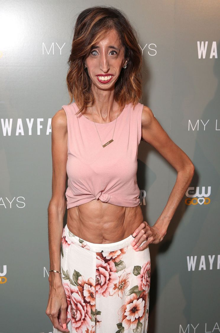 Lizzie Velasquez