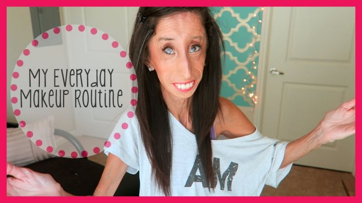 Lizzie Velasquez