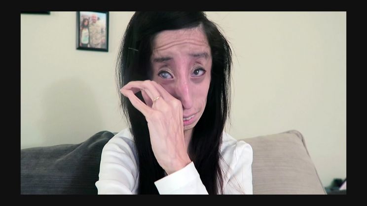 Lizzie Velasquez