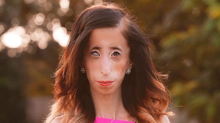 Lizzie Velasquez