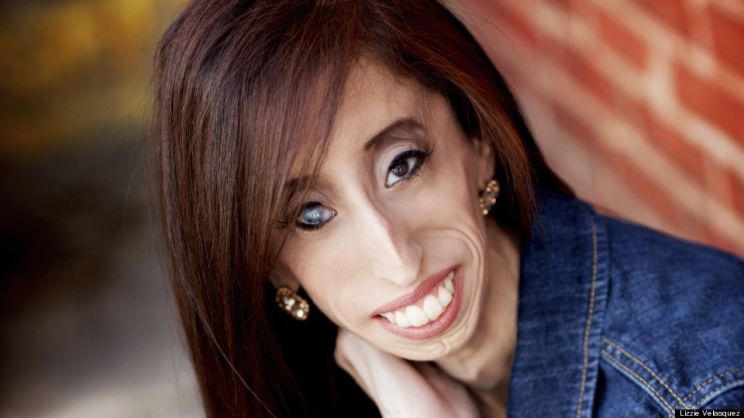 Lizzie Velasquez