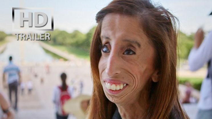 Lizzie Velasquez