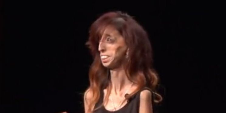 Lizzie Velasquez